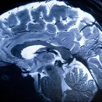 معرفی آخرین یافته‌های علوم اعصاب با حمایت ستاد علوم شناختی