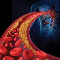 چربی خون هیچ علامتی ندارد!