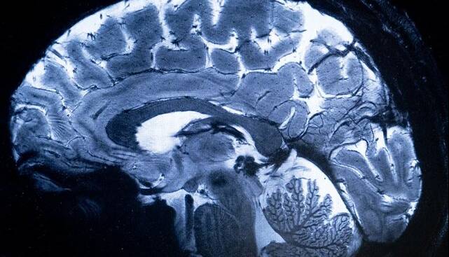 معرفی آخرین یافته‌های علوم اعصاب با حمایت ستاد علوم شناختی