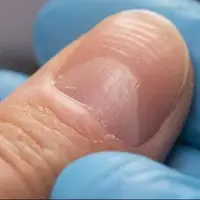 رازهایی که هلال ناخن برملا میکند!