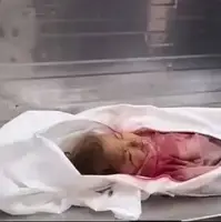 جنایت در غزه ادامه دارد!