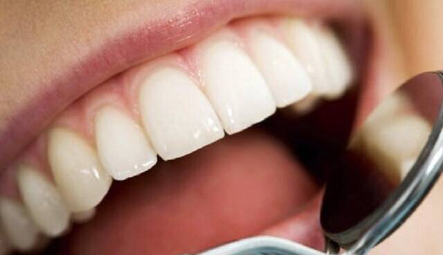 جرمگیری پایهایترین درمان دندانپزشکی و بیضرر است