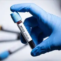 شناسایی سویه جدید «ام پاکس» در انگلیس