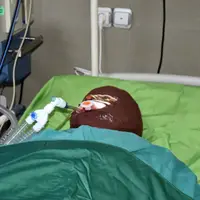 اسیدپاشی بهخاطر اختلافات ملکی!