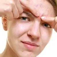 هشدار مهم برای کسانی که جوش‌هایشان را می‌ترکانند!