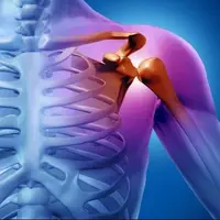 فرد چه زمانی دچار آرتروز می شود؟