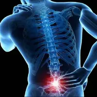 امید تازه برای درمان کمردردهای مزمن و ترمیم دیسک بینمهرهای