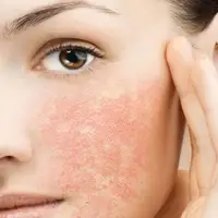 برای هر مشکل پوستی چی استفاده کنیم؟!