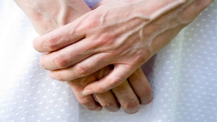 چرا رگ دستم سبز است؟