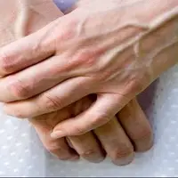 چرا رگ دستم سبز است؟