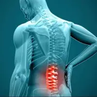 درمان دیسک کمر بدون جراحی!