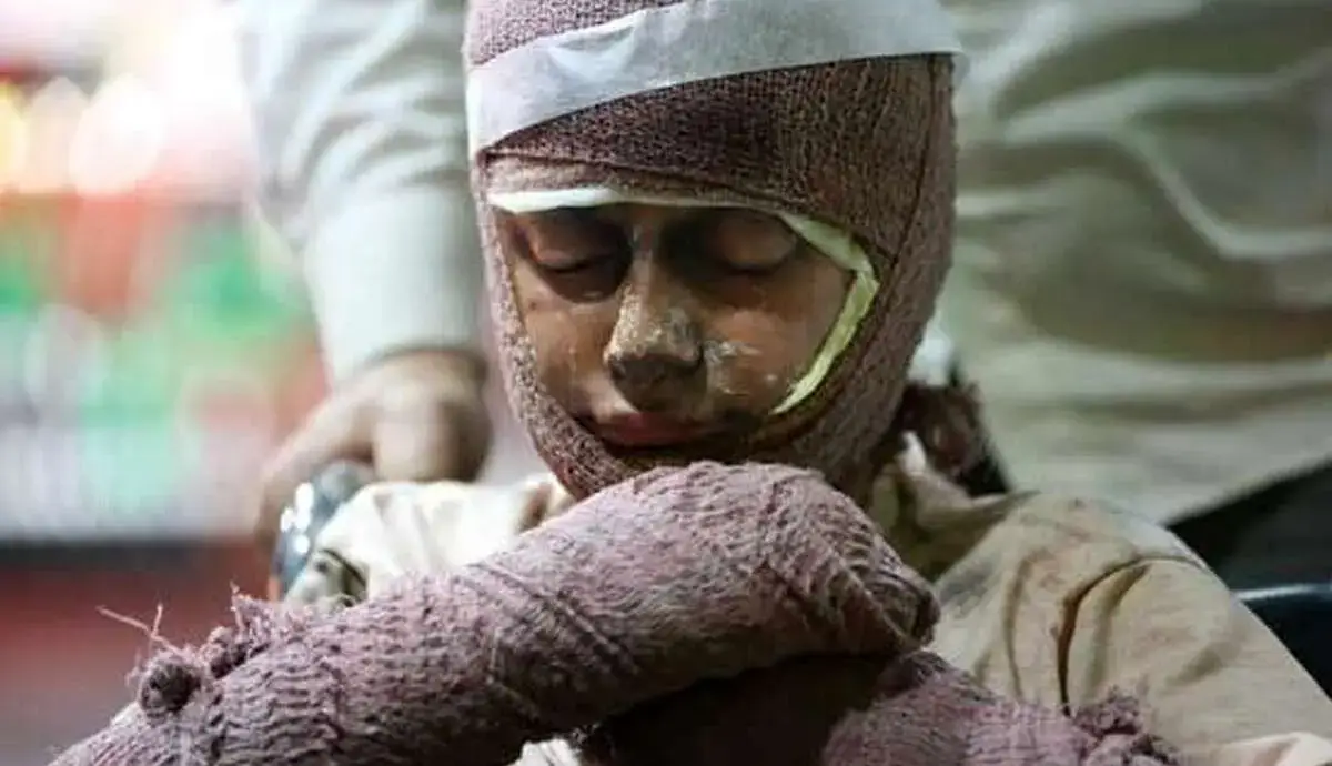 قیمت لباس سوختگی ۲ تا ۴۰ میلیون تومان