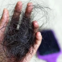 چرا موها در بارداری پرپشت میشوند و بعد از زایمان میریزند؟