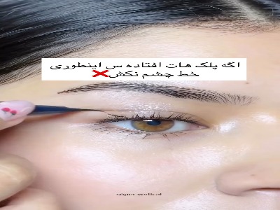 اگر پلک افتاده داری این ویدیو رو نگاه کن