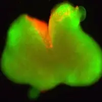 دستاوردی قابل توجه در ترمیم نخاع