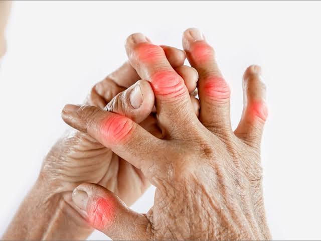 بیماری روماتیسم ارثی است؟