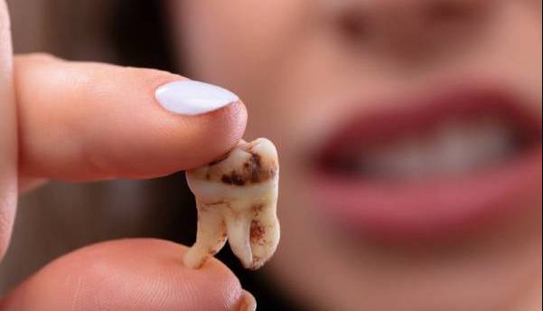 چرا عفونت دندان را نباید دستکم گرفت؟