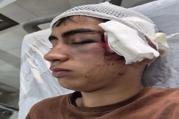 مصدومیت یک دانشآموز در پی برخورد فیزیکی معلم در بم