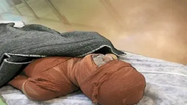 افزایش ۳۳ درصدی مرگومیر ناشی از سوختگی در آذربایجان شرقی